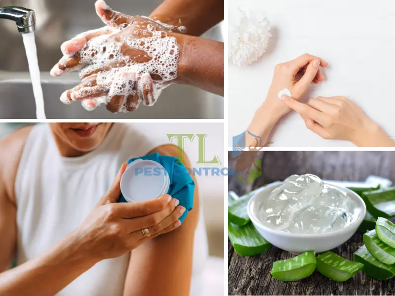 bị muỗi độc đốt sưng to