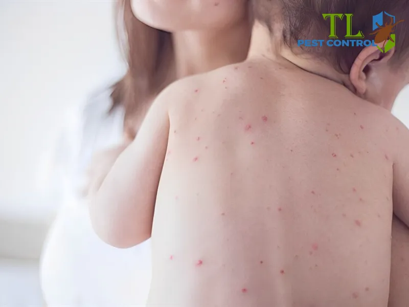 Các bệnh do muỗi gây ra cho trẻ sơ sinh