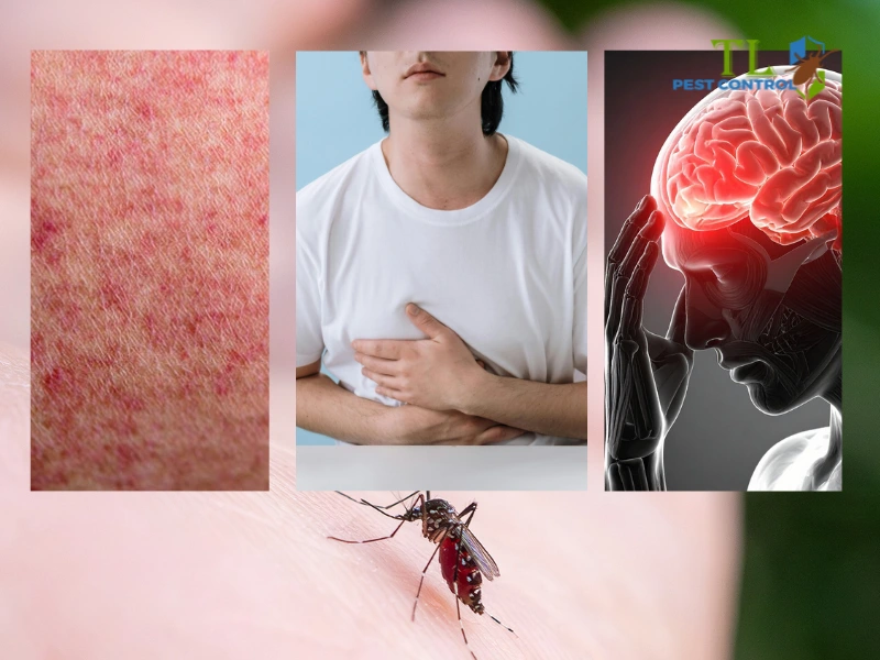 sau khi bị muỗi đốt sốt xuất huyết