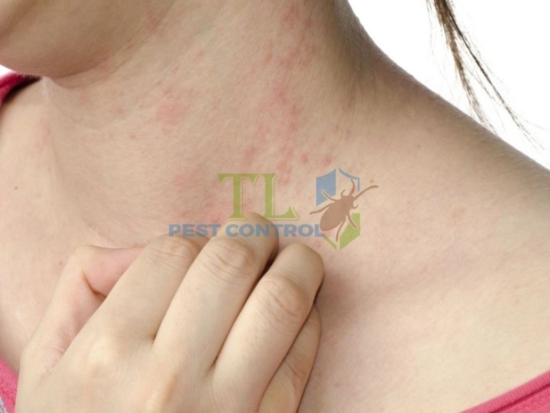 Tác động của mối đến sức khỏe con người và môi trường sống